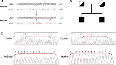 Identification of a novel homozygous LAMB3 mutation in a Chinese male with junctional epidermolysis bullosa and severe urethra stenosis: A case report